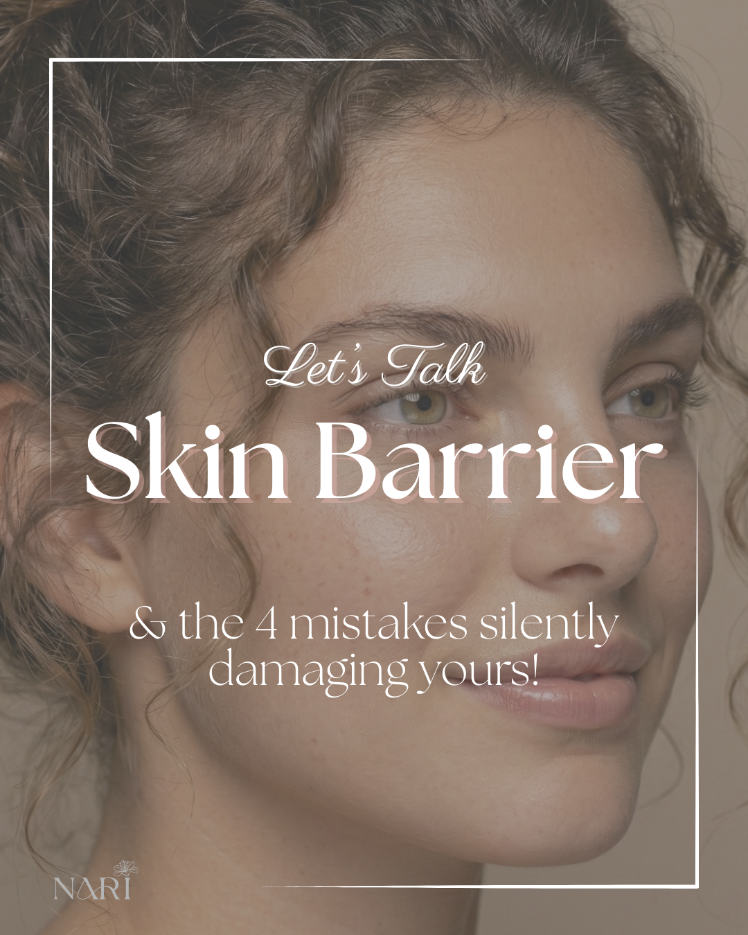 What is a skin barrier and the 4 mistakes quietly destroying it!