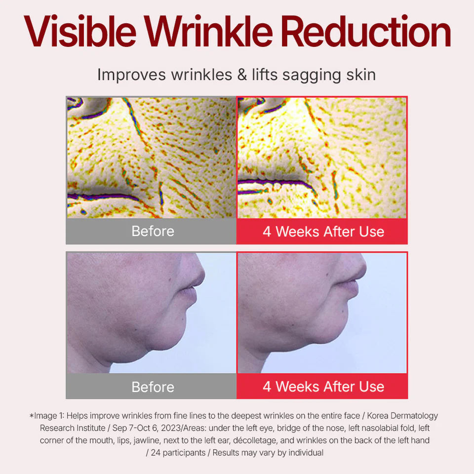Before and after effects of visible wrinkle reduction treatment on skin.
