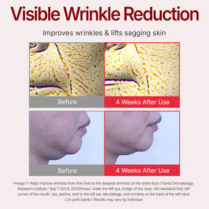 Before and after effects of visible wrinkle reduction treatment on skin.