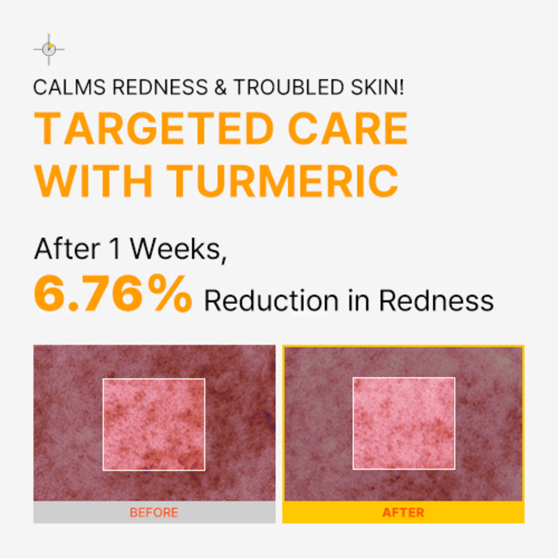 Turmeric Bubble Deep Mask