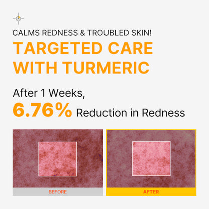 Turmeric Bubble Deep Mask