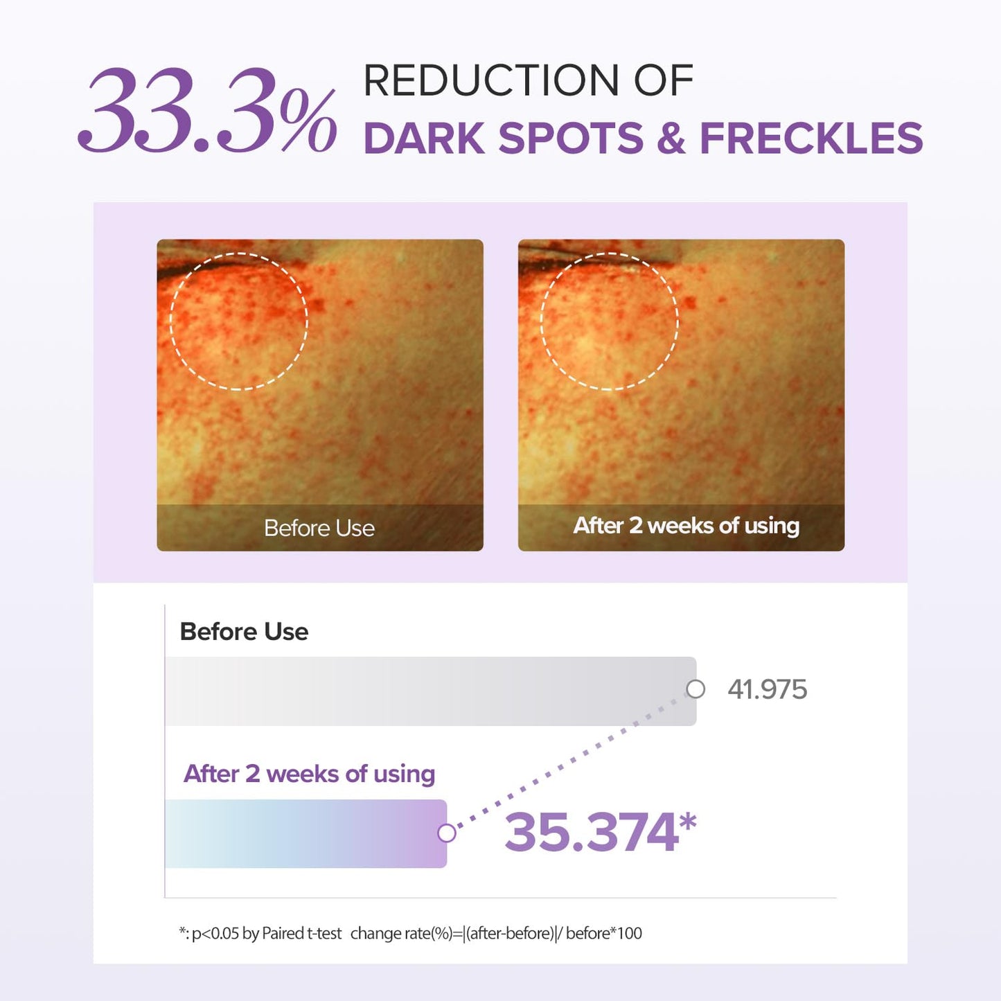 Tranexamic Acid+ Glutathion Eye Cream