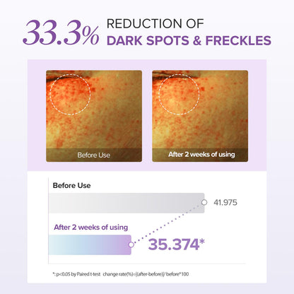 Tranexamic Acid+ Glutathion Eye Cream