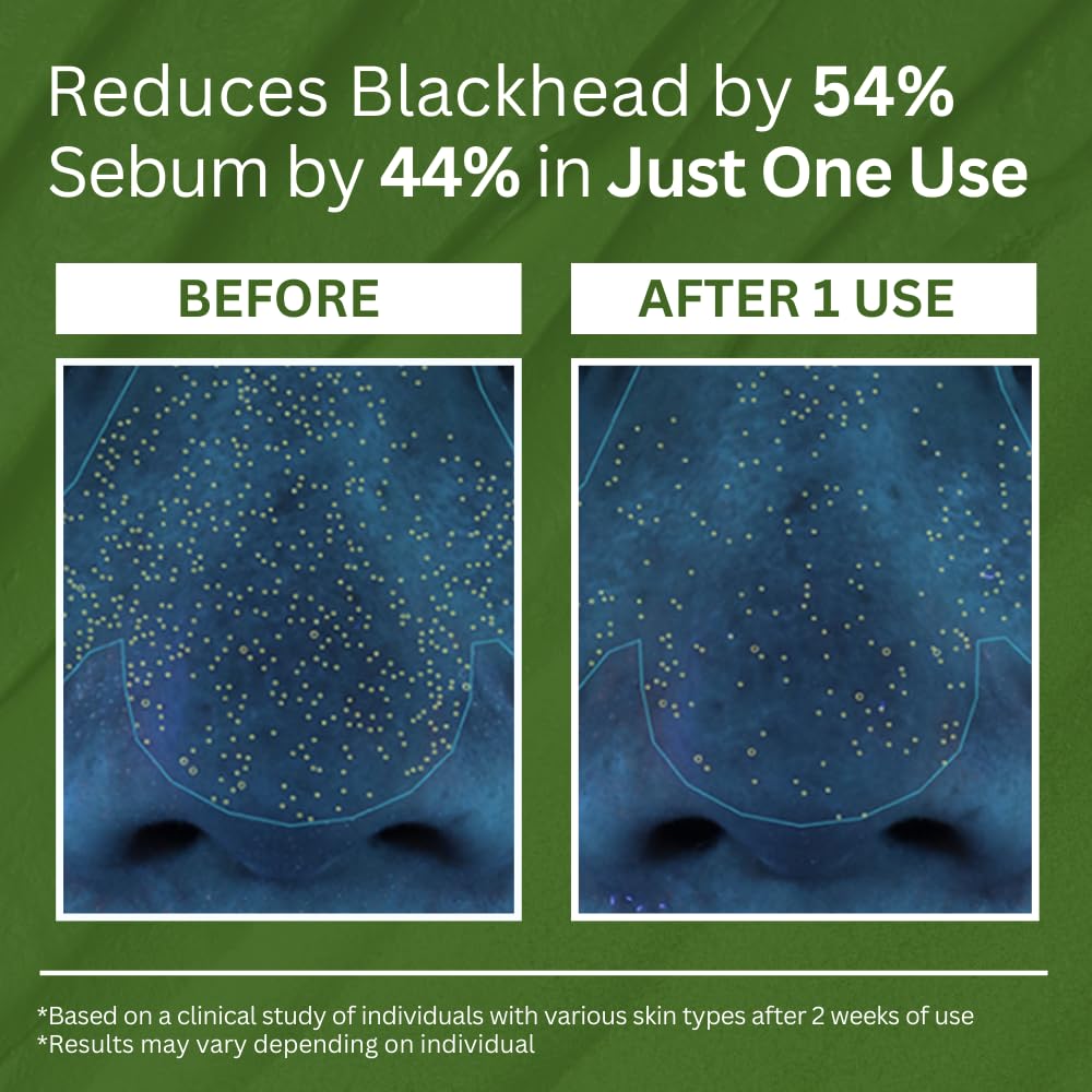 Hoy Basil Bubble Deep Mask