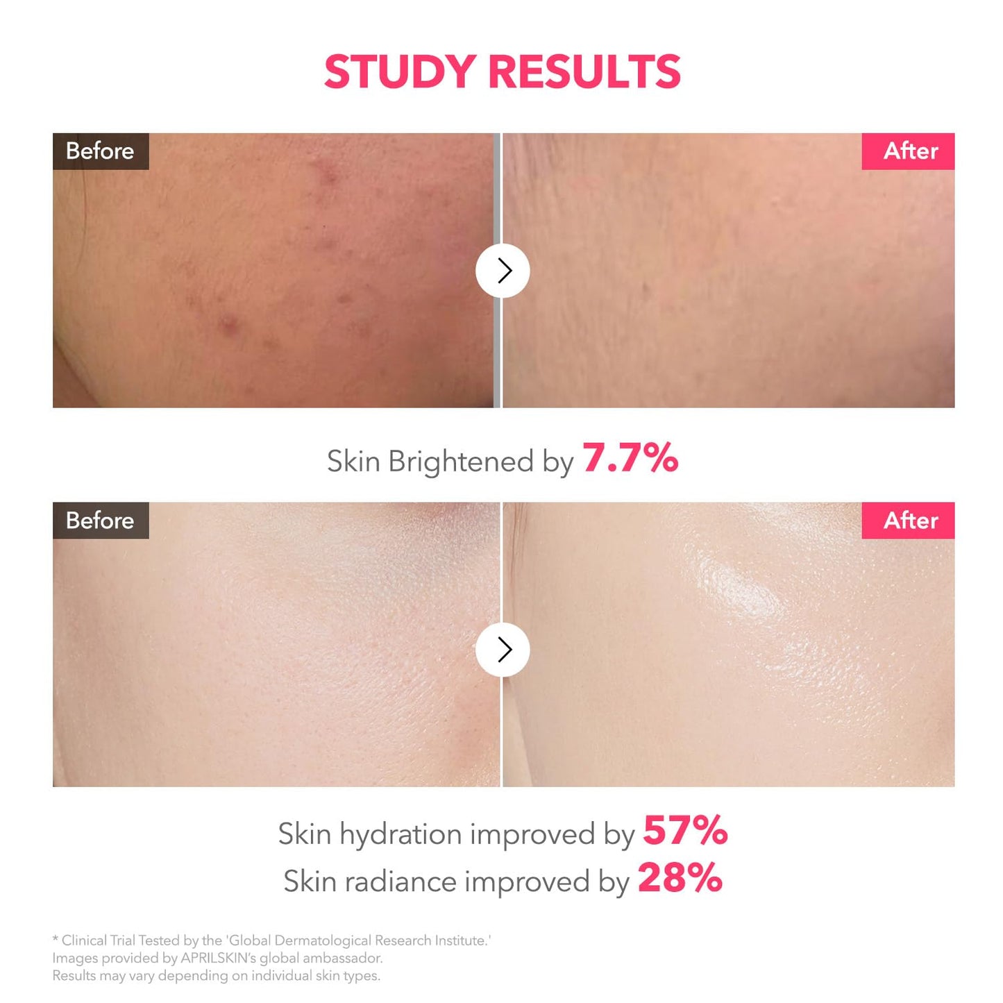 TXA NIACINAMIDE COLLAGEN 99 CAPSULE GEL MASK (4EA)