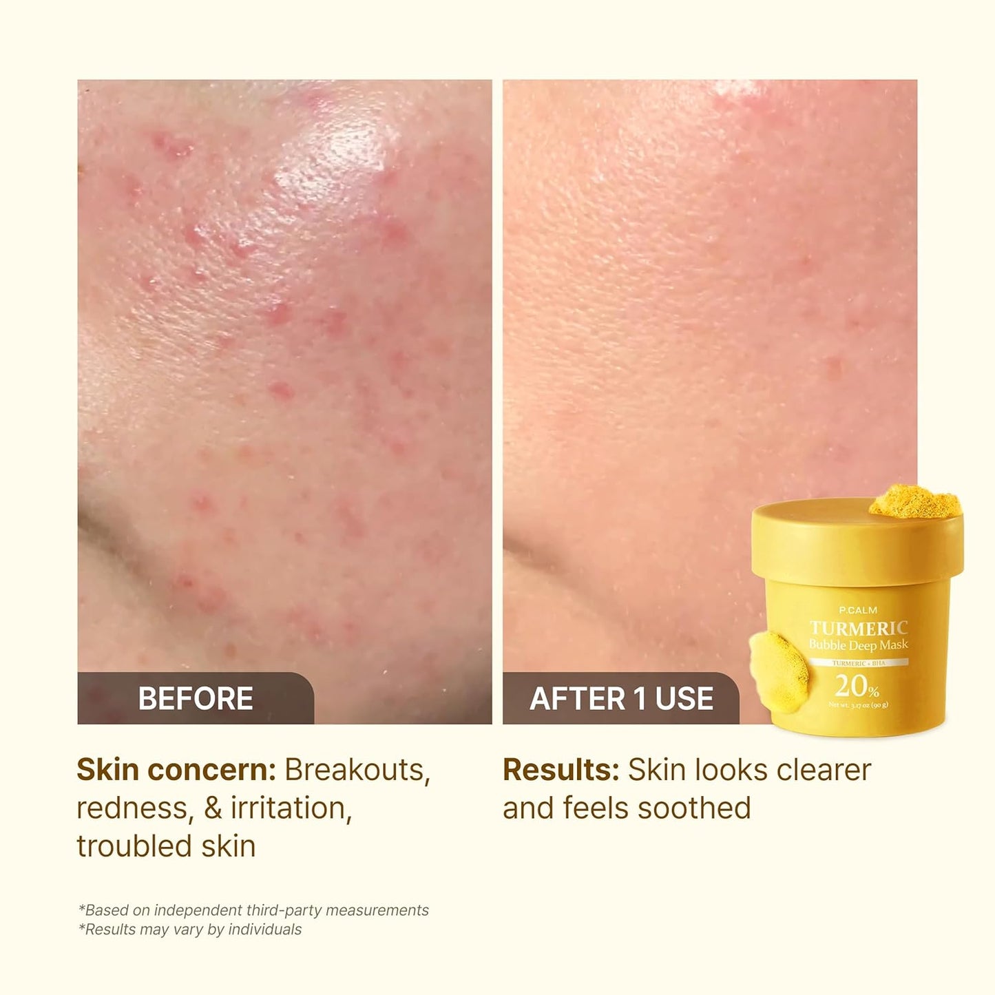 Turmeric Bubble Deep Mask