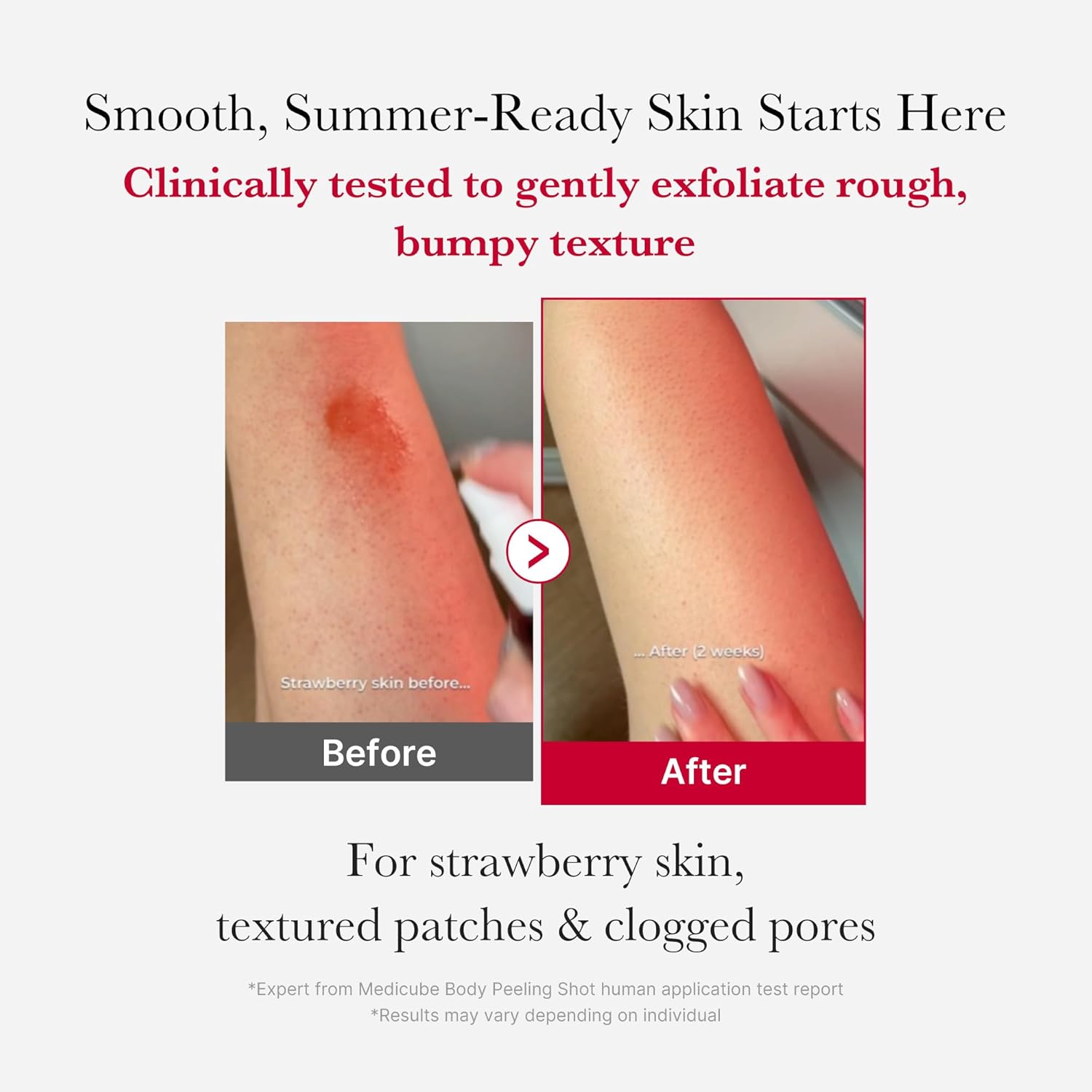 Before and after comparison of strawberry skin with a medicube Red Acne Body Peeling Shot application.