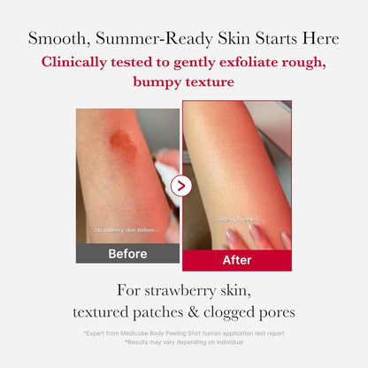 Before and after comparison of strawberry skin with a medicube Red Acne Body Peeling Shot application.