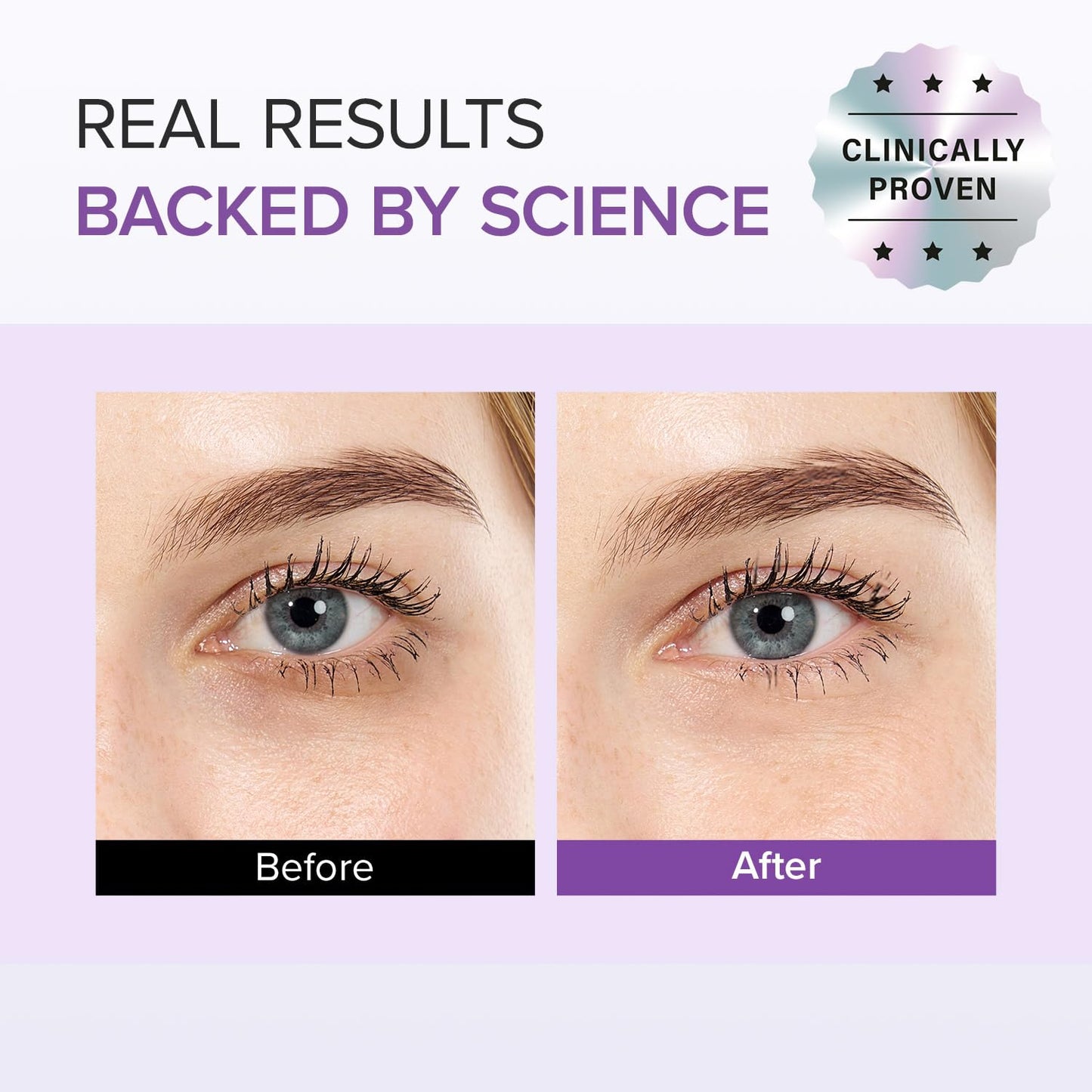 Tranexamic Acid+ Glutathion Eye Cream