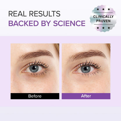 Tranexamic Acid+ Glutathion Eye Cream