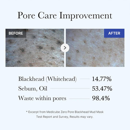 ZERO PORE BLACKHEAD MUD MASK