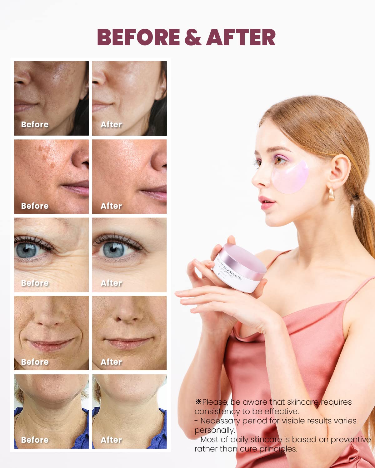 Retinol Advanced Regenerating Eye Gel Patches