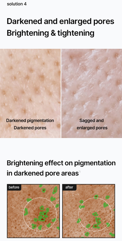 Pore + Dark Spot Brightening Cream