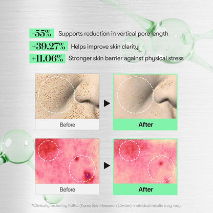 Reedle Shot 100 (+Gift: Reedle Shot 300)