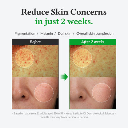 Gentle Vitamin C Serum