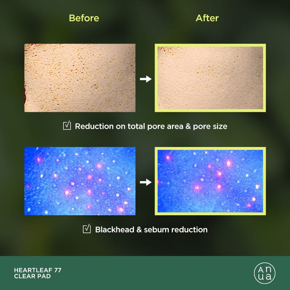 Heartleaf 77% Toner Pad